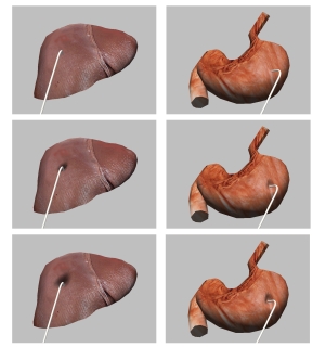 An efficient and scalable deformable model for virtual reality based medical applications