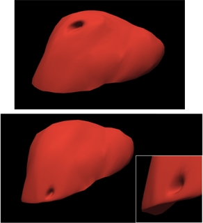 Interactive deformation of soft tissues with haptic feedback for medical learning