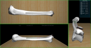 Virtual Haptic System for Intuitive Planning of Bone Fixation Plate Placement